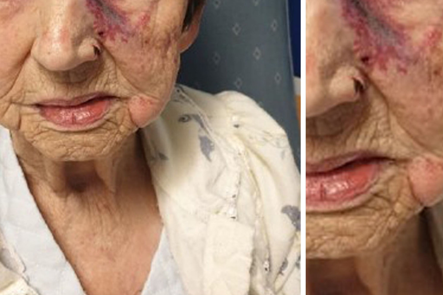 The Chief Constable of Merseyside Police appeals for help following an attack on a 93-year-old woman 